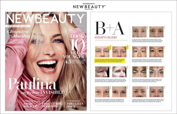 Dr. Natalie Attenello featured in New Beauty