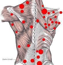 Trigger point.