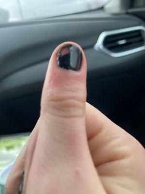 My chipped nail