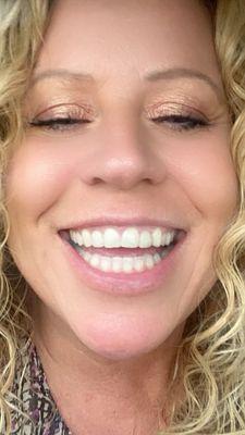 My beautiful smile thanks to Dr. Magri! Highly recommend.