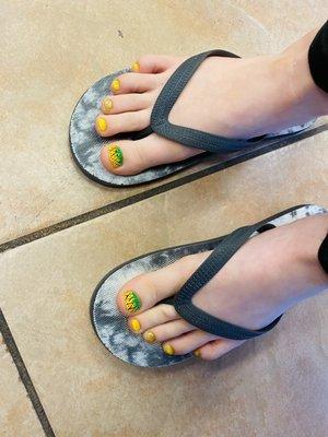 Custom pineapples on my daughters toes