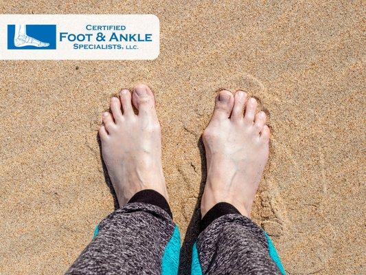 bunion foot care