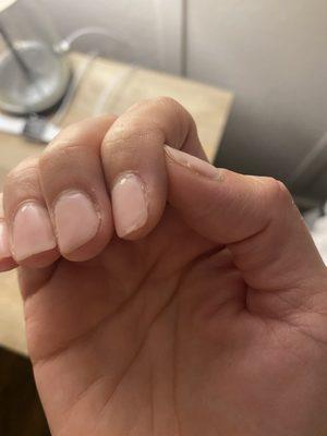 3 days after my gel manicure. It's all just so bad.