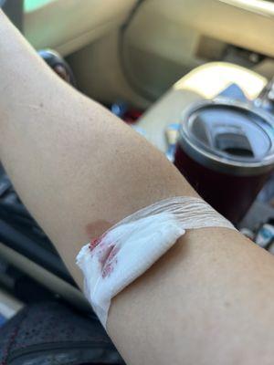 Probably the least clean blood draw I've had in a while, for which I waited nearly half an hour beyond my appointment time.