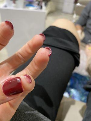 Cut my skin from filling my nail so hard