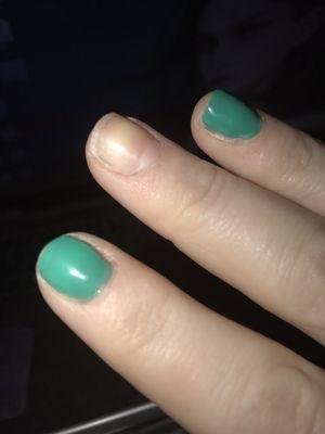 What is left of my shellac manicure showing old color on the side and the shellac up over my cuticles which were not properly trimmed