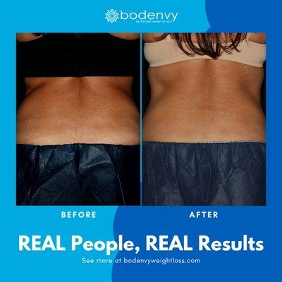 Bodenvy Weight Loss Orlando