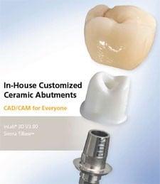 Custom crowns and implant abutments