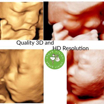 3D, 4D and HD Ultrasound