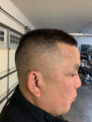 High skin fade