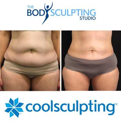 The Body Sculpting Studio