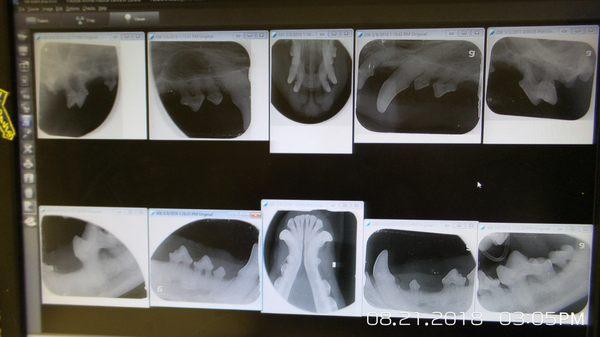 Full Mouth Dental X-rays are part of a Comprehensive Oral Health Assessment Treatment done on EVERY dental patient!