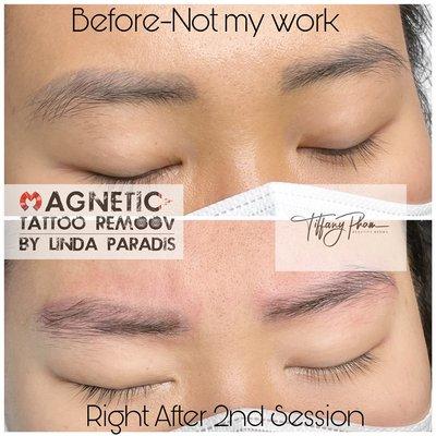 Magnetic Tattoo Removal on previous 1 year old Microblading brows