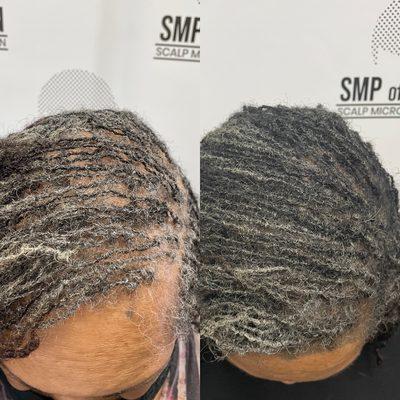 We filled in the grids to add density to these beautiful Sisterlocks.