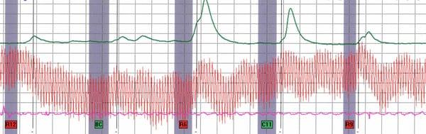 When the truth Really Matters...
 NY Forensic Polygraph
 (917)854-1010
 www.ForensicPolygraph.com