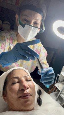 Getting my micro-needling facial. Microneedling is a minimally invasive procedure for your skin. Your healthcare provider uses thin needles