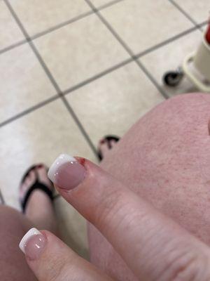 This nail was the worst.