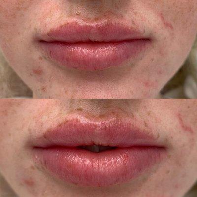 Beautiful lips by Erin