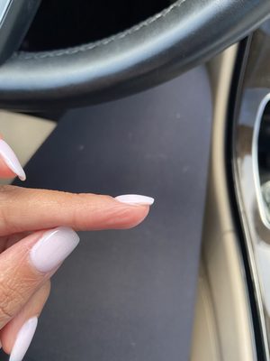 Left middle nail after attempting to file the lump