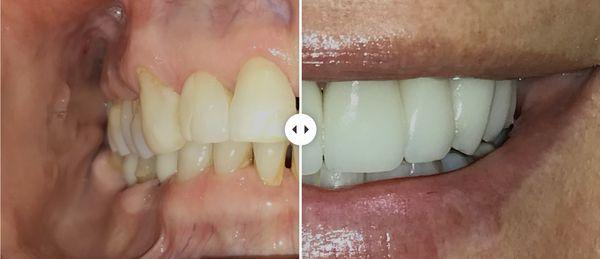 An incredible smile transformation!