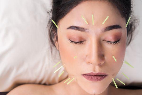 Acupuncture Facial Rejuvenation