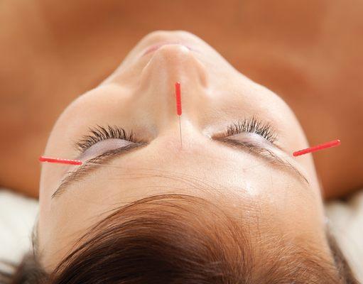 Acupuncture and Holistic Care