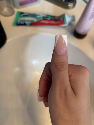 uneven nails