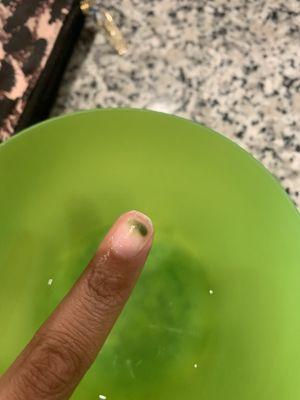 Green Nail Syndrome