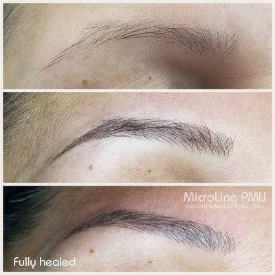 MicroBlading