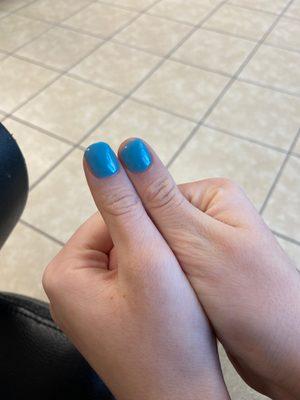 two very different nail lengths that are definitely not okay