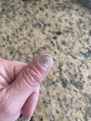 Fungus on natural nail after coming to this salon