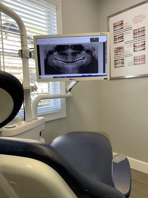 Low Dose Digital Dental X-rays