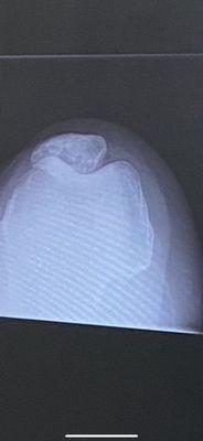 Kneecap before surgery