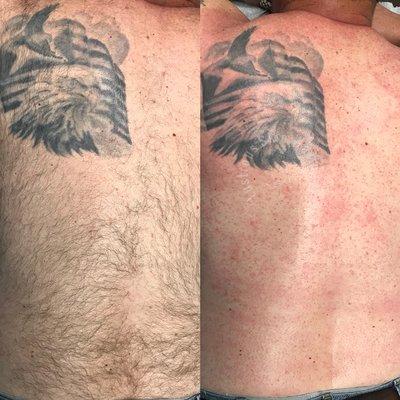 Before and after on back waxing.