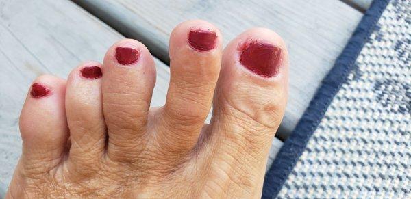 Horrible Pedicure!