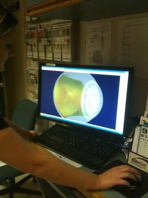 The optomap Retina images an ultra-widefield view of the retina (the back of the eye) without using dilating drops.