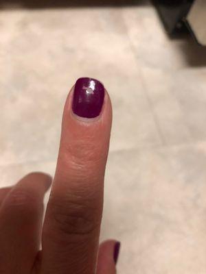 Another chipped nail