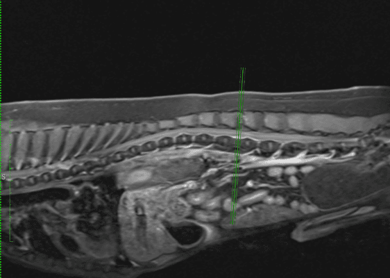 Our neurologist is available to read MRIs for any suspected disc herniation cases 7 days a week