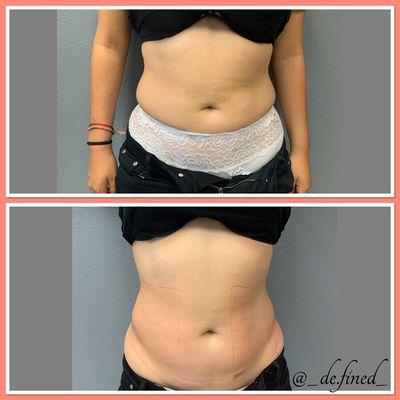 Before and after my client's 1st session and in only ONE hour!!