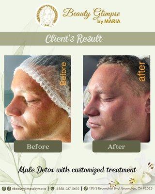 Oooohhh, our client looks more younger after just a session of Male detox and customized treatment!