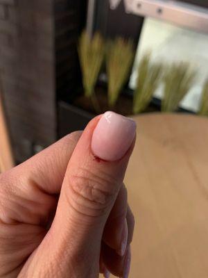 Cut cuticle