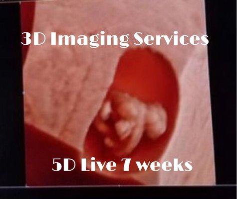 5D Ultrasounds now available. Calll 212-462-4464 to schedule your appointment 212-462-4462