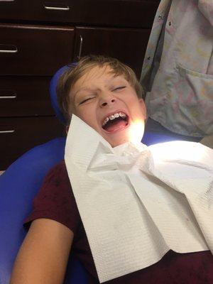 Braces for 10 year old and he's laughing and having fun because staff is so awesome and friendly.