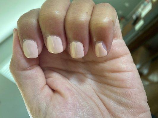 chipping gel polish and really bad polishing job.