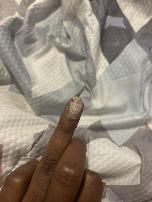 My nail after the cut was cleaned