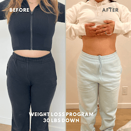 Patient lost 30lbs after 3 month program