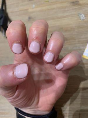 Hangnails after the manicure