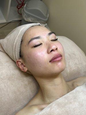 Our most popular treatment: Deep Clean + Hydration Facial