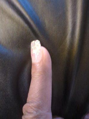 The tip is lined up with the cuticle on this side but not the other side