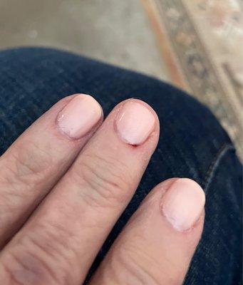 Damage from cuticles cut roughly.